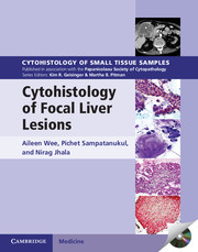 Cytohistology of Focal Liver Lesions with CD-Rom