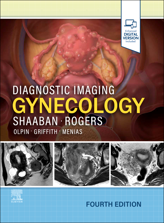 Diagnostic Imaging: Gynecology 4e