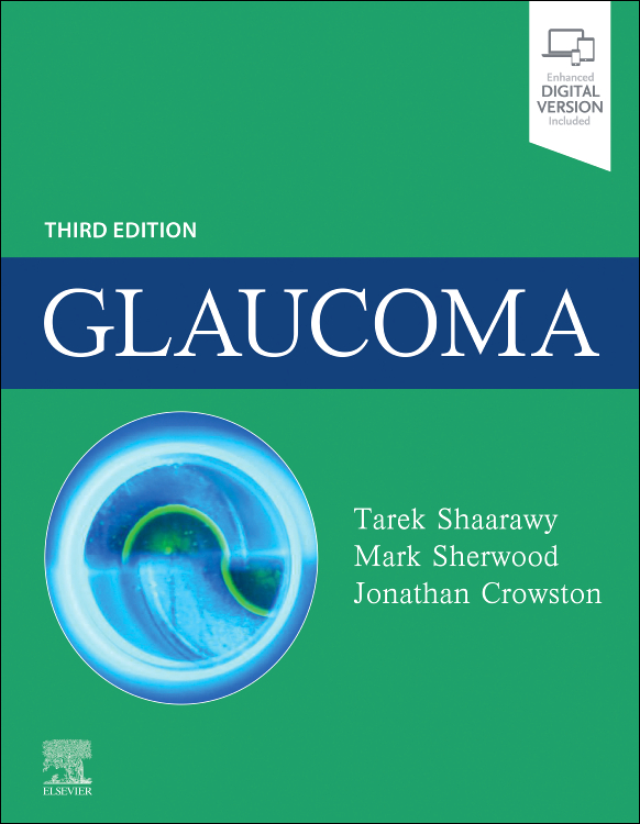 Glaucoma 3e