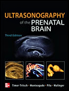 Ultrasonography of the Prenatal Brain,3/e