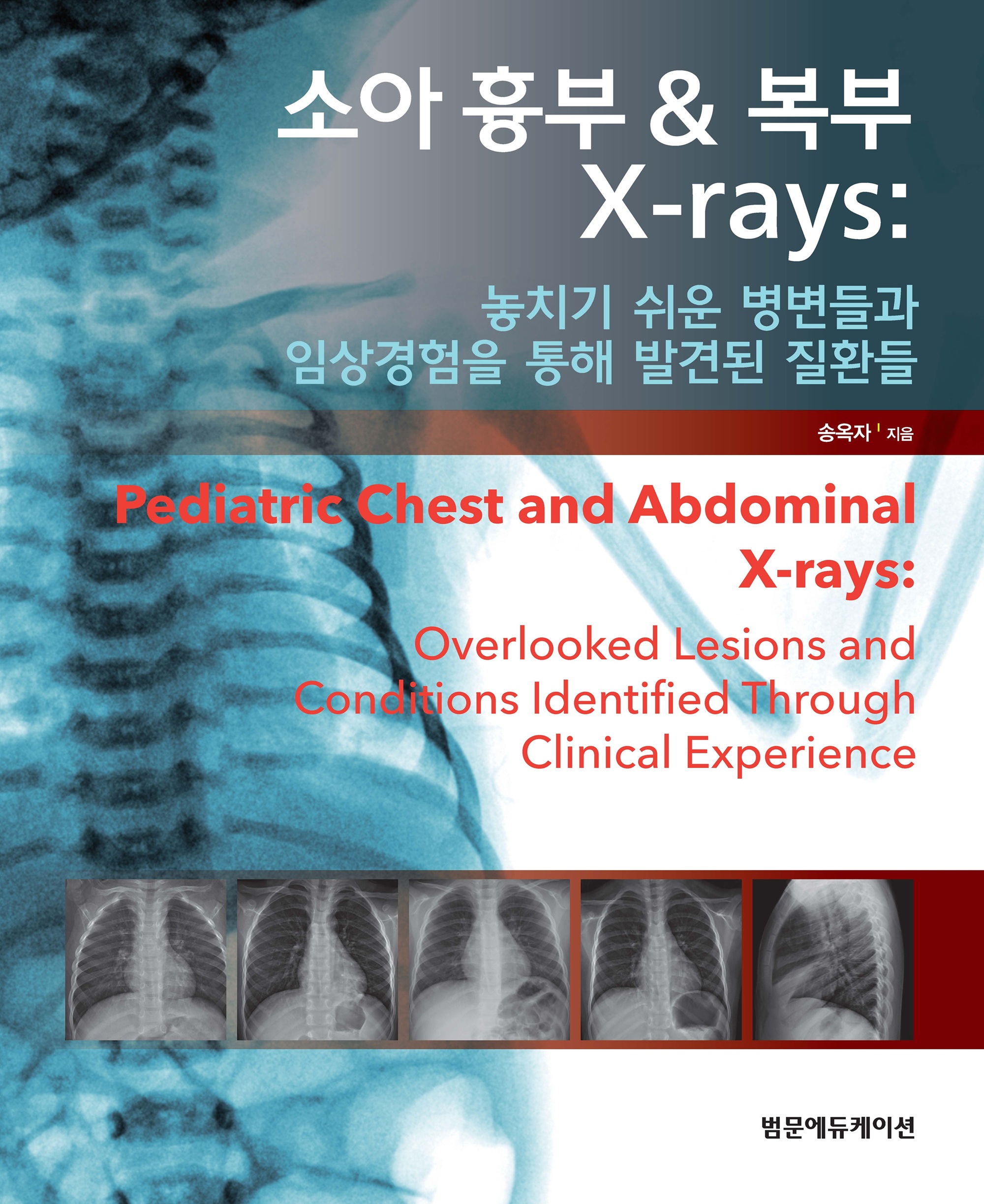 소아 흉부 복부 X-rays 놓치기 쉬운 병변들과 임상경험을 통해 발견된 질환들(10/20이후 출고 가능)