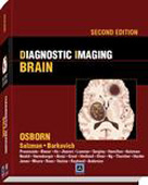 Diagnostic Imaging:Brain,2/e
