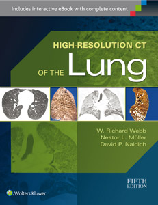 High-Resolution CT of the Lung,5/e
