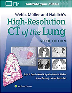 High-Resolution CT of the Lung 6e