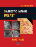 Diagnostic Imaging:Breast,2/e